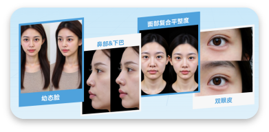 医美案例对比展示